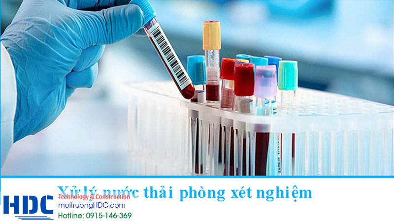 Vì sao cần xử lý nước thải phòng xét nghiệm tại Hà Nội?